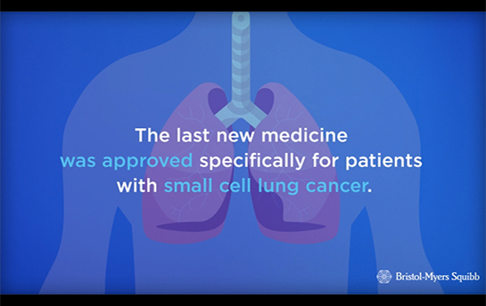BMS Animated Infographics